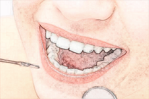 珠海市人民醫(yī)院正畸醫(yī)生怎么樣?2024正畸收費貴嗎