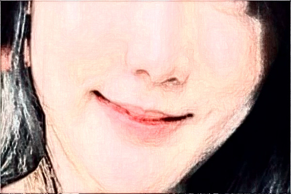 沈陽盛京醫(yī)院祛斑好不好?體驗(yàn)日記反饋