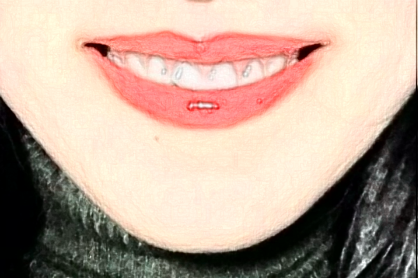 蘇北人民醫(yī)院牙科地包天矯正哪個醫(yī)生好_醫(yī)生推薦