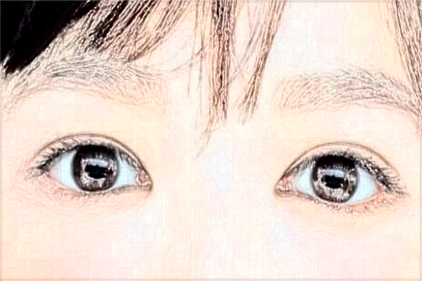 2024吉林大學(xué)第一醫(yī)院全飛秒做的好嗎?誰做得好