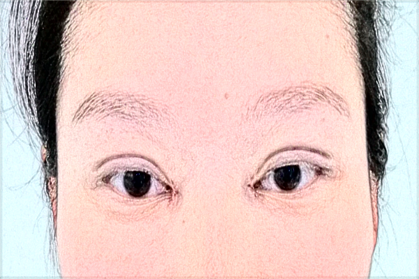 2024延邊醫(yī)院半飛秒做的好嗎?誰(shuí)做得好