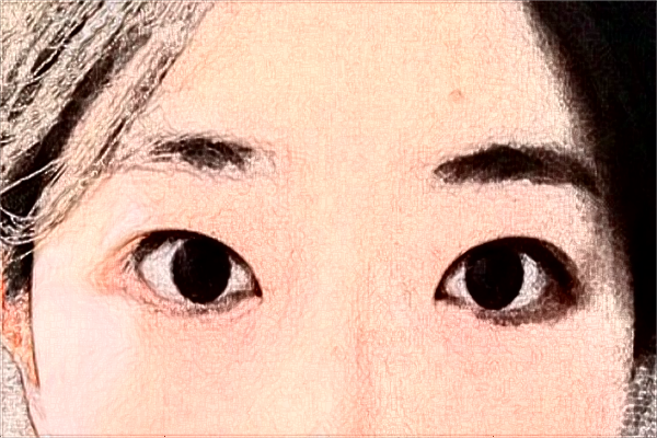 2024鎮(zhèn)江江濱醫(yī)院全飛秒怎么樣?哪個(gè)醫(yī)生做的比較好