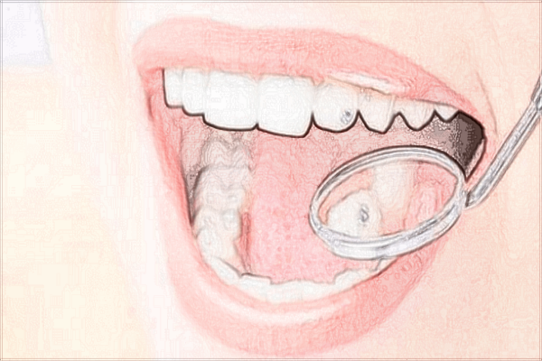 2024惠州市中心人民醫(yī)院拔一顆智齒多少錢?拔智齒貴嗎