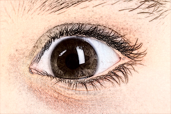 2024常德市第一人民醫(yī)院近視手術(shù)價(jià)格?近視手術(shù)多少度能做