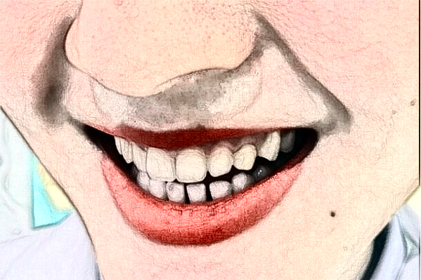 無(wú)錫市第一人民醫(yī)院口腔科鑲牙怎么樣_醫(yī)生名單推薦