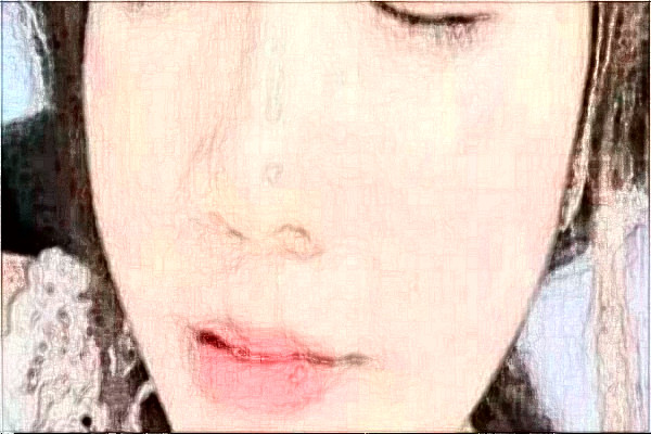 南通大學(xué)附屬醫(yī)院去胎記怎么樣_體驗(yàn)日記分享