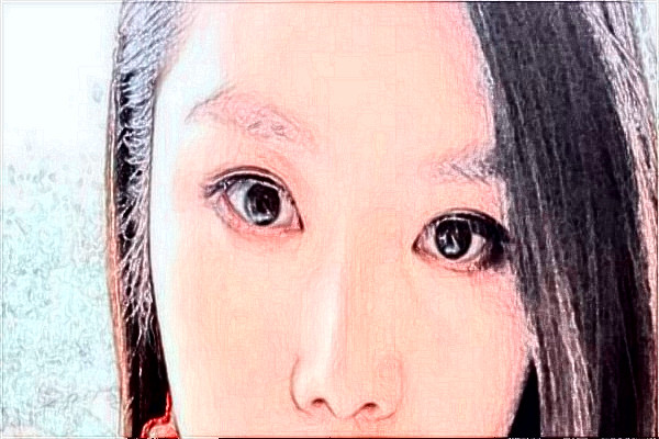 天津醫(yī)科大學(xué)總醫(yī)院熱瑪吉需要多少錢?醫(yī)生推薦