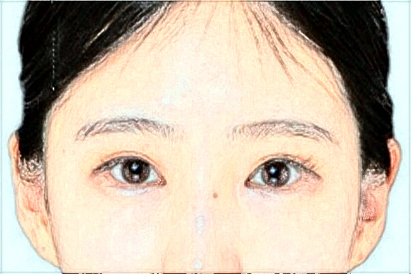 綿陽(yáng)市中心醫(yī)院激光美容怎么樣_真實(shí)案例反饋