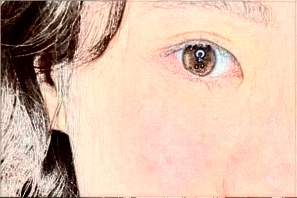 揚(yáng)州市第一人民醫(yī)院割雙眼皮技術(shù)好嗎?醫(yī)生介紹