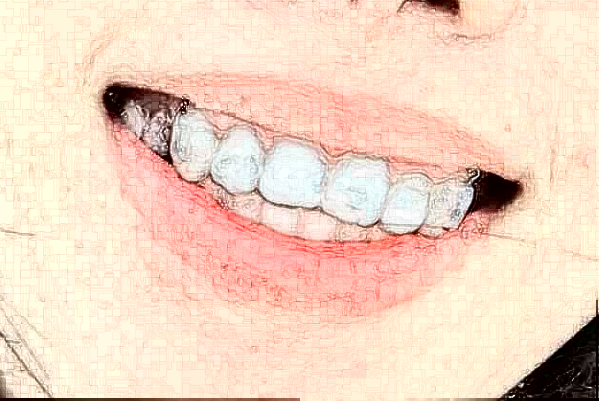 揚(yáng)州市第一人民醫(yī)院正畸醫(yī)生排名_口碑+價格