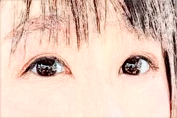 2024江蘇省人民醫(yī)院全飛秒價(jià)目表(價(jià)格表)怎么樣