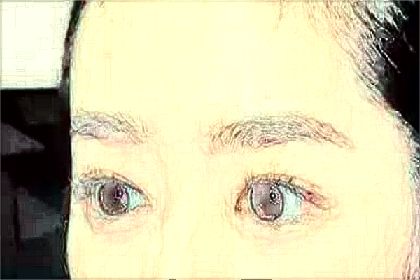 2024江蘇省人民醫(yī)院半飛秒好不好?體驗(yàn)日記反饋