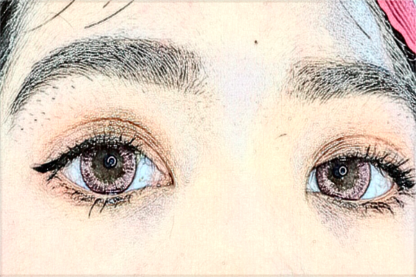 2024無錫市第一人民醫(yī)院激光去紋眉做的可以嗎？