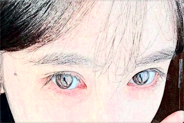 2024無錫市第一人民醫(yī)院激光去紋眉做的可以嗎？