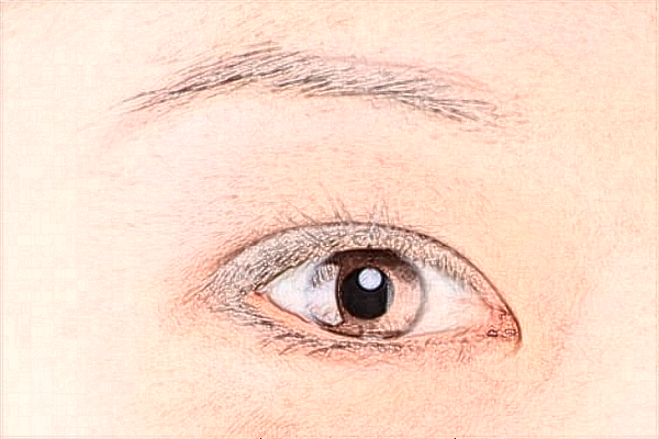 2024佛山市第二人民醫(yī)院全飛秒手術(shù)費(fèi)用?全飛秒手術(shù)的危害