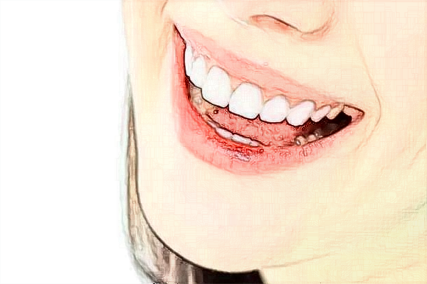 2024煙臺中醫(yī)院牙科收費價目表?全瓷牙價格怎么樣?