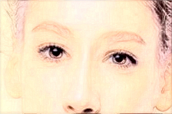 2024綿陽市中心醫(yī)院激光祛痘坑多少錢?做的怎么樣