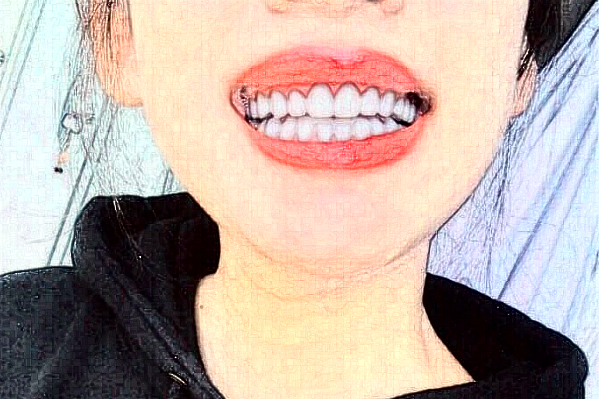 2024河北省人民醫(yī)院口腔科根管好不好?醫(yī)生有哪些