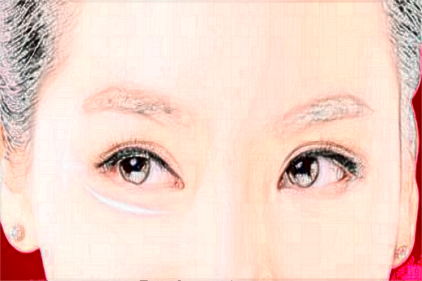 蘇北人民醫(yī)院半飛秒做的好嗎?誰做得好