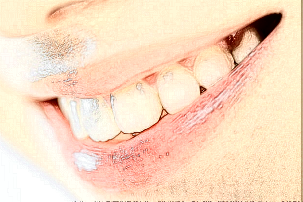 大慶市人民醫(yī)院口腔科隱形矯正價格多少?做的怎么樣