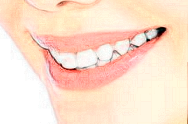 鎮(zhèn)江江濱醫(yī)院義齒修復(fù)價(jià)目表(價(jià)格表)怎么樣