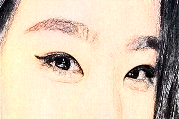 佛山市第二人民醫(yī)院雙眼皮手術好嗎?附雙眼皮案例