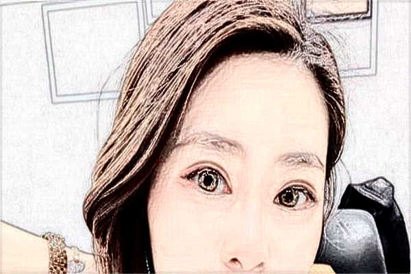 ?？谑腥嗣襻t(yī)院醫(yī)美怎么樣?醫(yī)美項目都有哪些