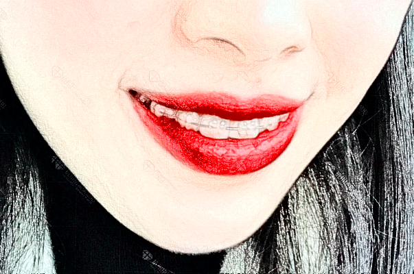 2024蘇州康美美容醫(yī)院鑲牙怎么樣_誰(shuí)做得好