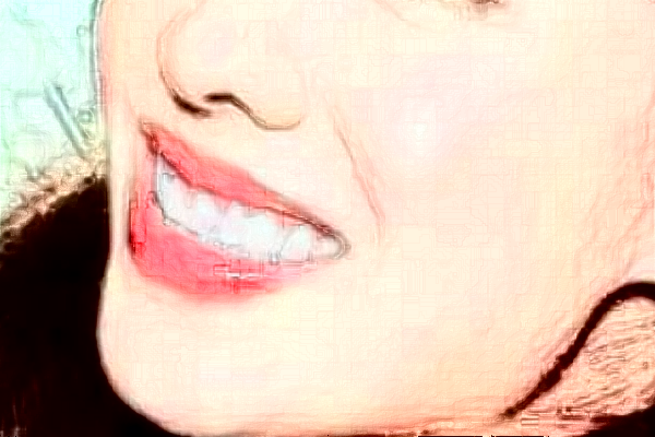 2024太原眾牙口腔醫(yī)院冷光美白怎么樣_體驗(yàn)日記分享