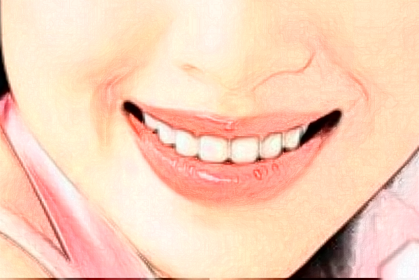 2024河北省人民醫(yī)院口腔科錯畸形矯正做的好嗎?真實案例反饋