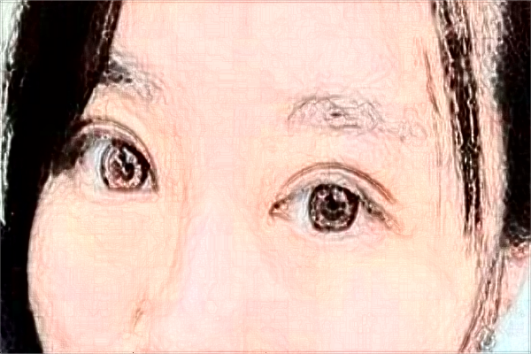 安徽醫(yī)科大學(xué)第一附屬醫(yī)院做雙眼皮價目表(價格表)怎么樣