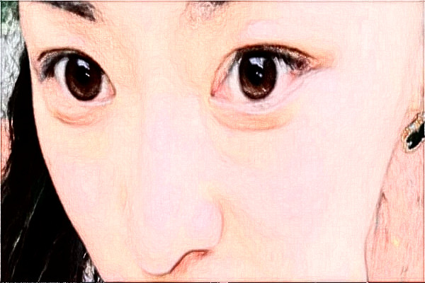 大連大學(xué)附屬新華醫(yī)院脂肪填充價格多少_醫(yī)生排名