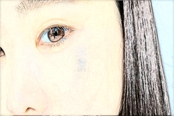 南京鼓樓醫(yī)院去胎記做的好嗎？誰做的好