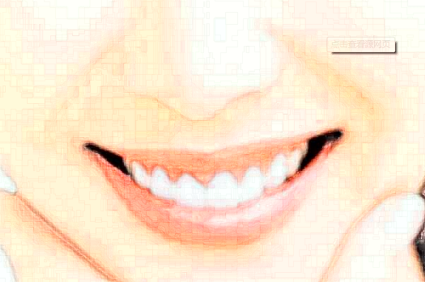 徐州醫(yī)科大學(xué)附屬醫(yī)院拔牙怎么樣_整形日記分享