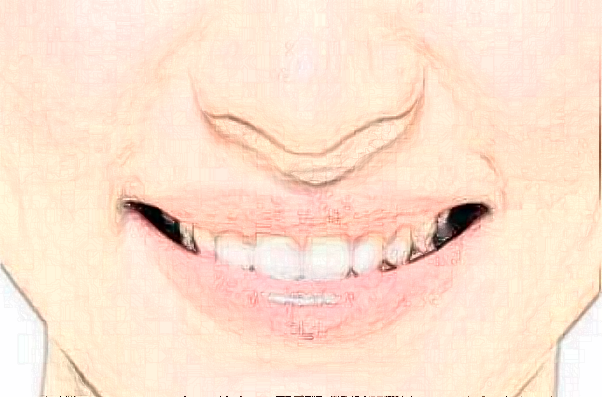 2024齊齊哈爾市中醫(yī)院根管怎么樣_誰(shuí)做得好