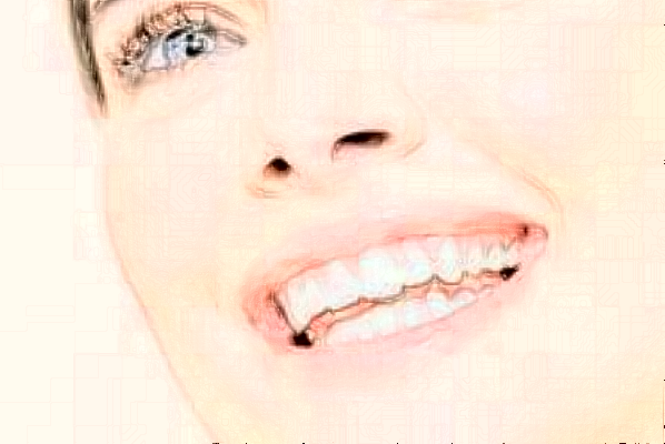 2024齊齊哈爾市中醫(yī)院牙齒美容怎么樣_整形日記分享