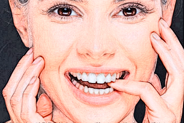 2024齊齊哈爾市中醫(yī)院牙齒美容怎么樣_整形日記分享