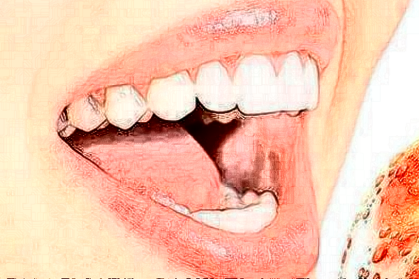 齊齊哈爾市中醫(yī)院種植牙怎么樣_誰做得好