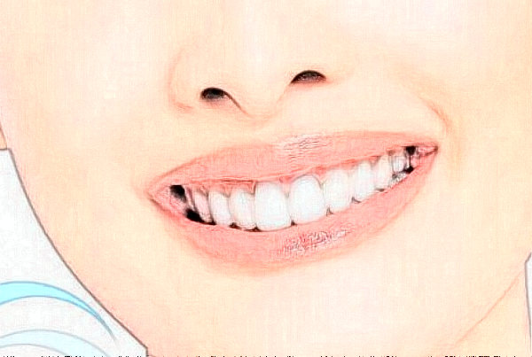 沈陽盛京醫(yī)院補(bǔ)牙好不好?體驗(yàn)日記反饋