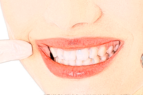 成都圣貝牙科醫(yī)院種植牙好的醫(yī)生推薦_美容日記展示