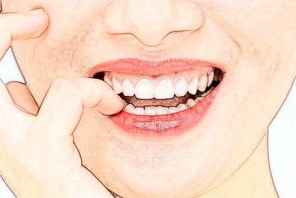 長沙科爾雅口腔醫(yī)院口腔修復(fù)好的醫(yī)生推薦_美容日記展示