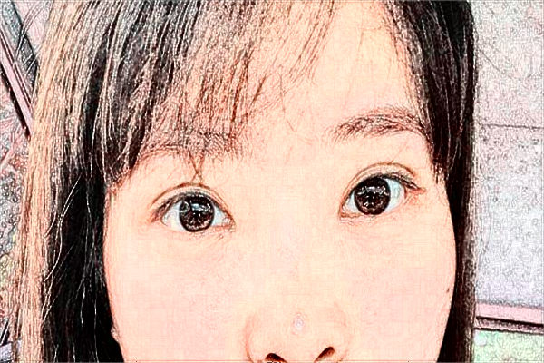 2024煙臺毓璜頂醫(yī)院去黑眼圈好嗎?激光去黑眼圈價格?