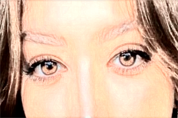 2024株洲市中心醫(yī)院雙眼皮手術收費價格?割雙眼皮好嗎