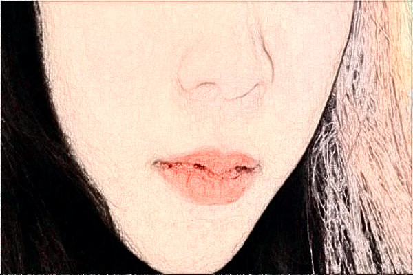 2024安徽醫(yī)科大學(xué)第一附屬醫(yī)院祛斑價(jià)格需要多少_真實(shí)案例分享