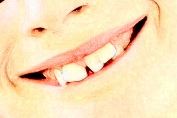 南京中大醫(yī)院口腔科根管怎么樣_案例展示