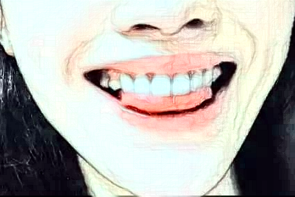 南京中大醫(yī)院口腔科根管怎么樣_案例展示