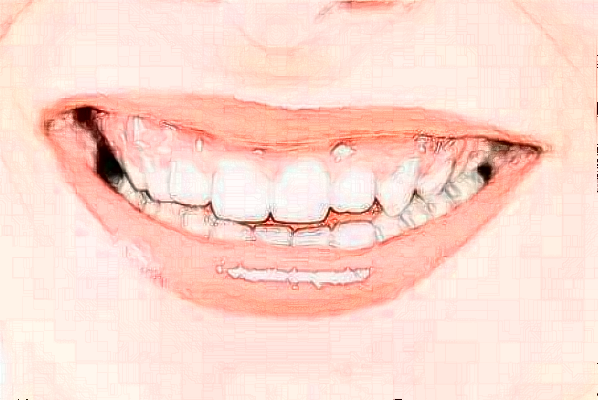 2024安徽醫(yī)科大學第一附屬醫(yī)院拔牙做的好嗎?哪位醫(yī)生做得好