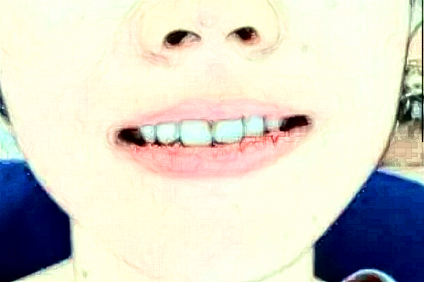 ?？谑腥嗣襻t(yī)院正畸科哪個醫(yī)生好?2024正畸收費價格?