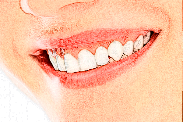 武漢大學(xué)口腔醫(yī)院種植牙疼不疼?種植牙價(jià)格曝光