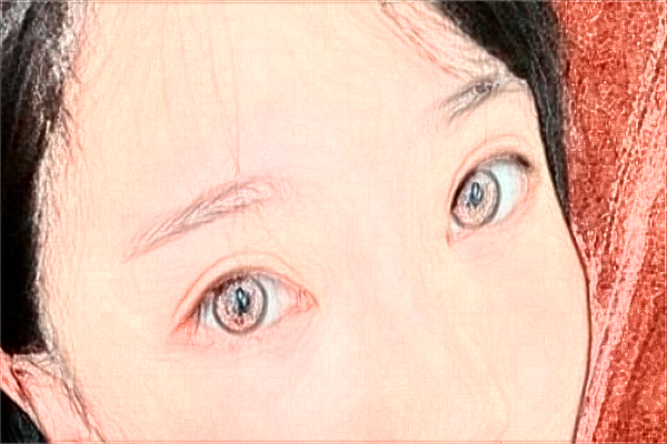 佛山市第二人民醫(yī)院去黑頭怎么樣?2024去黑頭價格